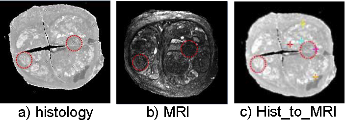 Registration of histological and MR images of the same prostate.