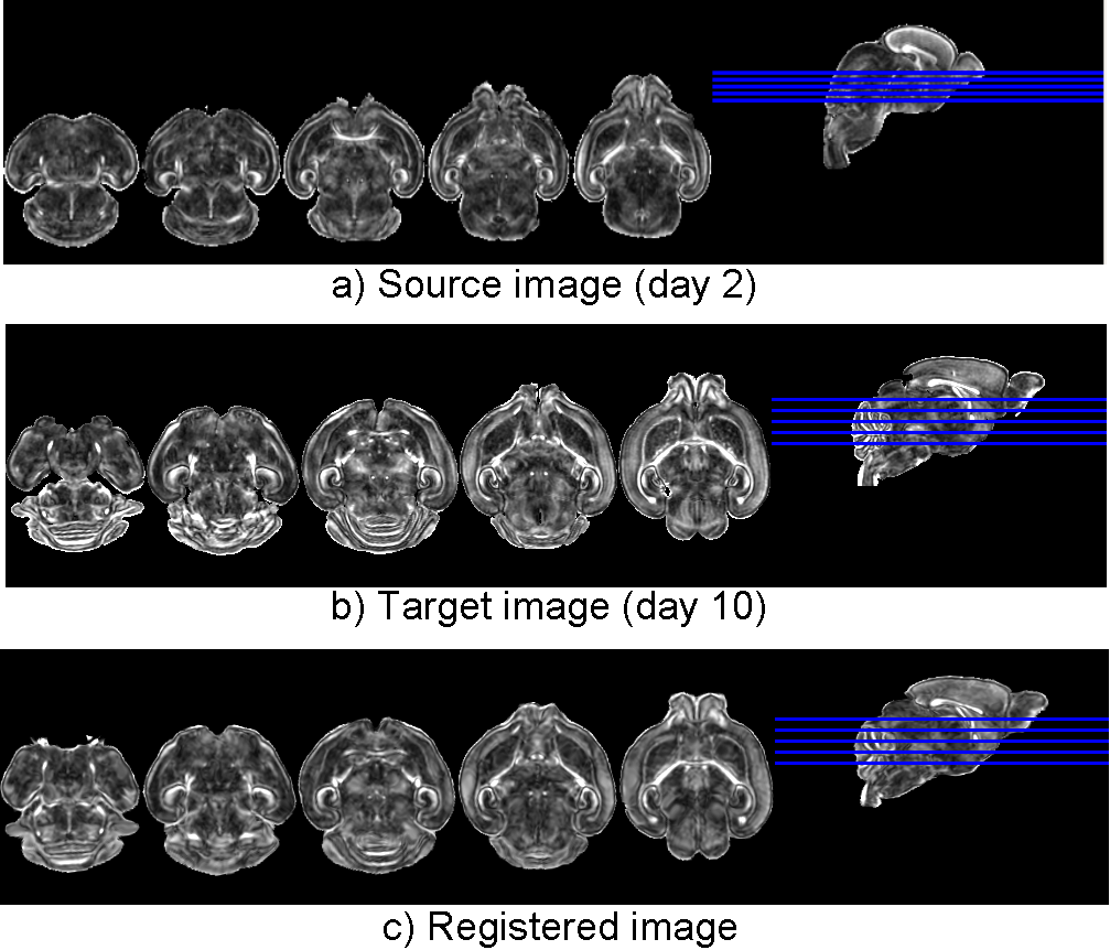 Registration of longitudinal mouse brain images.